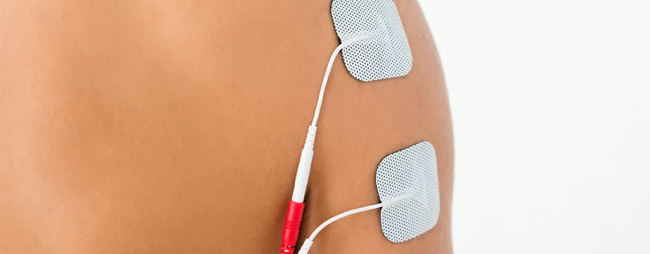 Electrical Stimulation Therapy - Goldman Physical Therapy