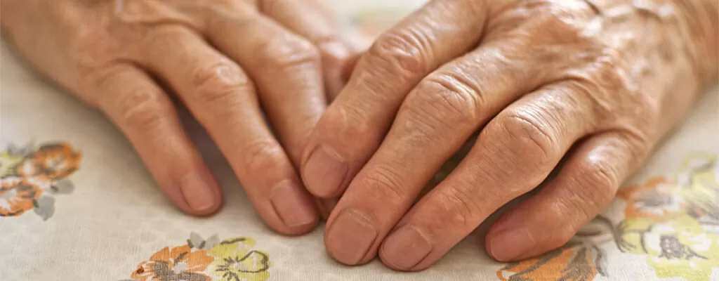 a man suffering from Arthritis Pain